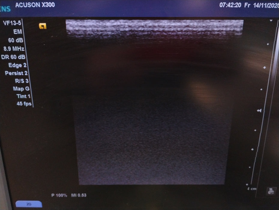 Siemens Acuson X300 Ultrasound