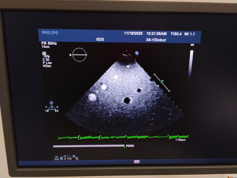 Philips X5-1 Cardiac xMATRIX Sector Array Transducer