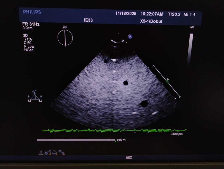 Philips X5-1 Cardiac xMATRIX Sector Array Transducer