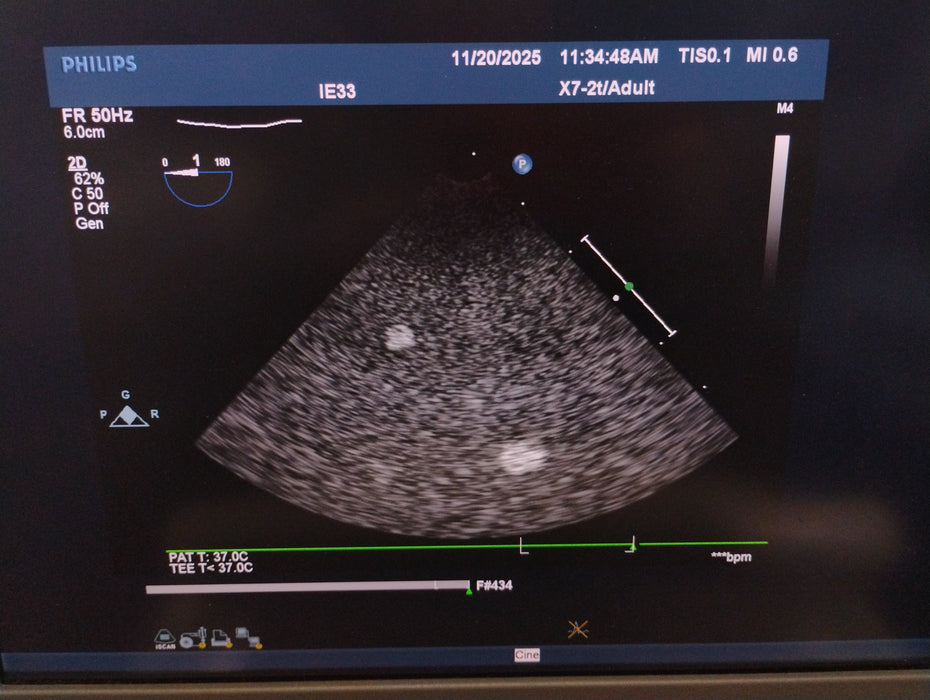 Philips X7-2t TEE Probe Transducer IE33 Version