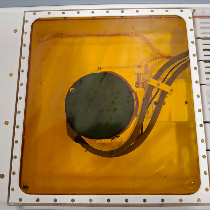 InSightec ExAblate Ultrasound System