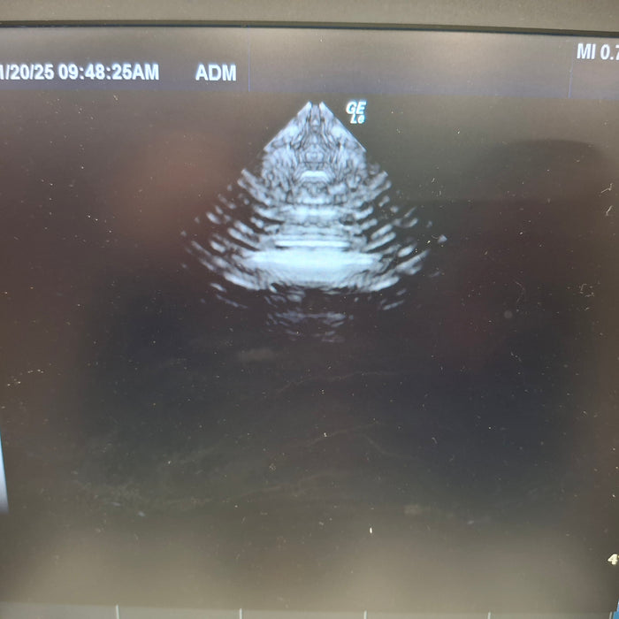 GE Healthcare NextGen Logiq e Ultrasound