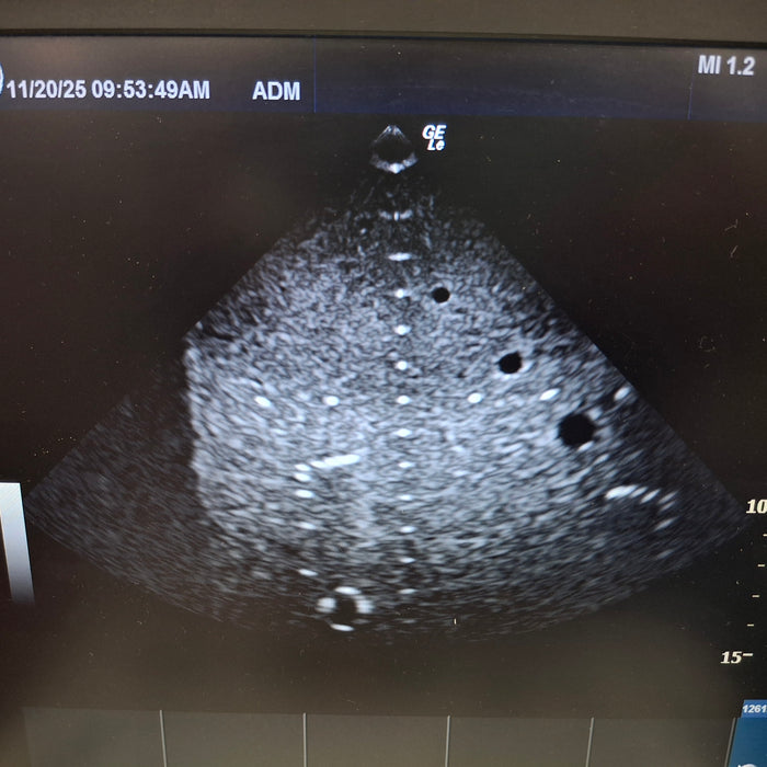 GE Healthcare NextGen Logiq e Ultrasound