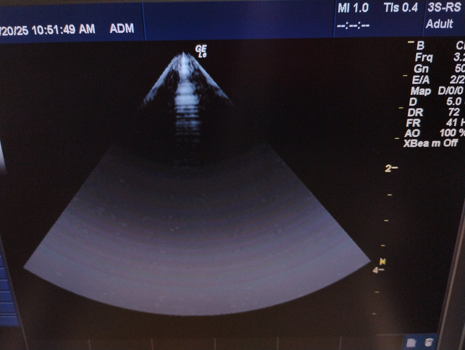 GE Healthcare C1-5-RS Convex Transducer