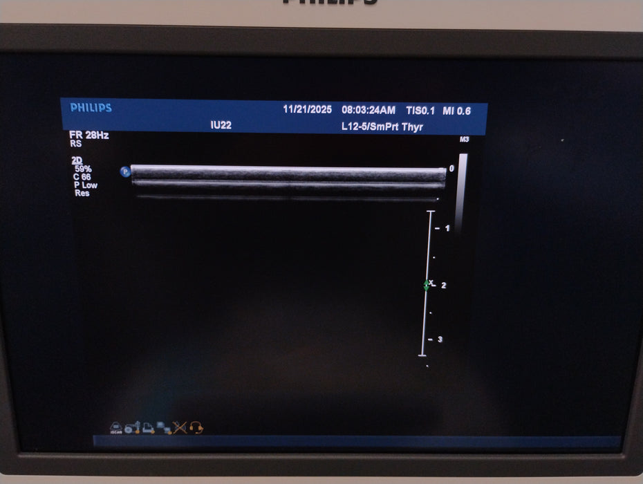 Philips IU22 Ultrasound