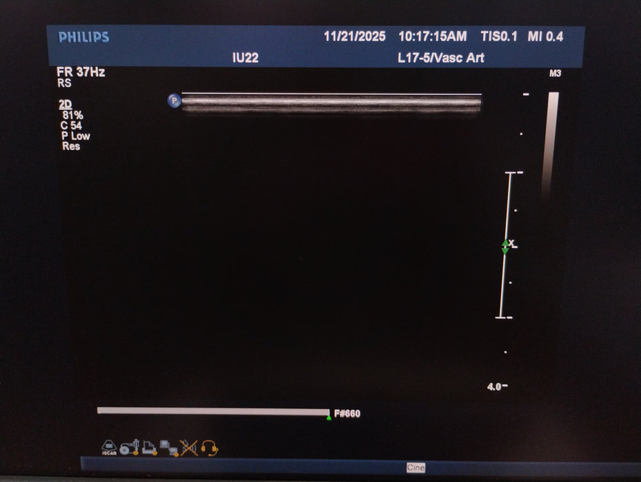 Philips IU22 Ultrasound
