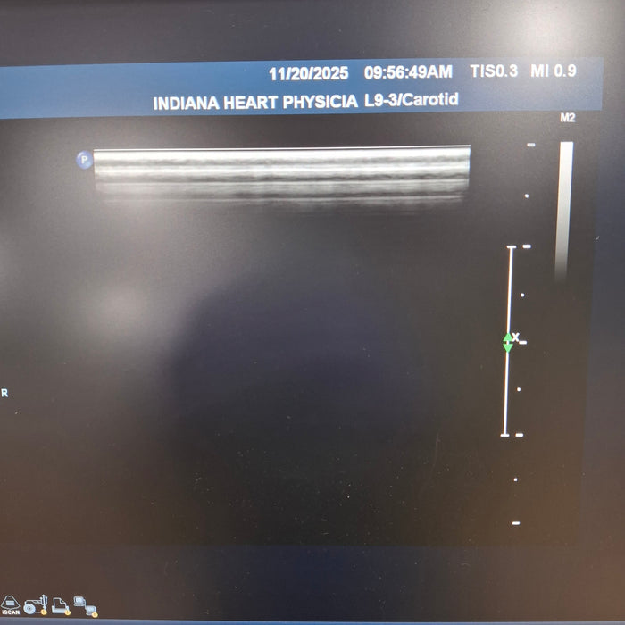 Philips L9-3 Linear Array Transducer