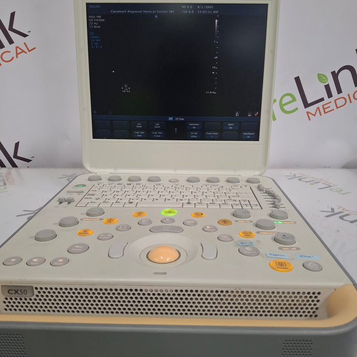 Philips CX50 Ultrasound