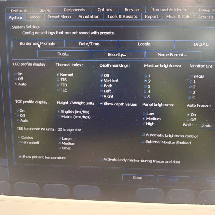 Philips CX50 Ultrasound