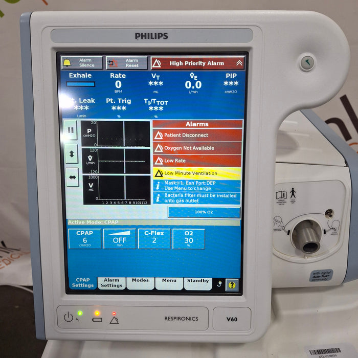 Philips Respironics V60 BiPAP Ventilator