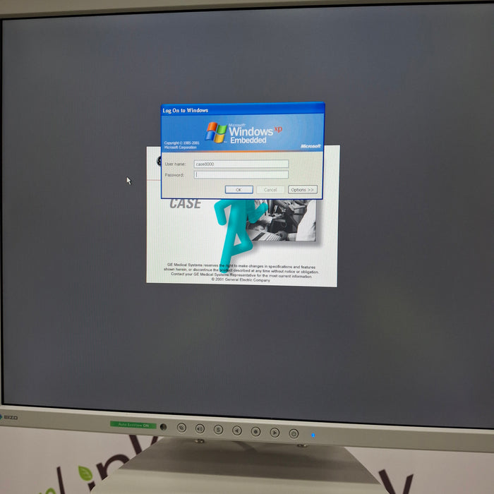 GE Healthcare Case P2 Stress Test Console