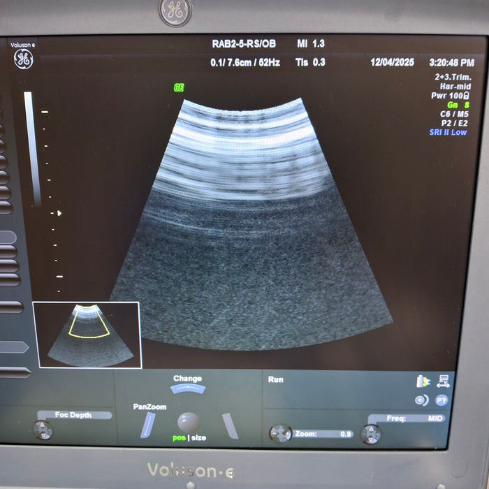 GE Healthcare Voluson e Portable Ultrasound