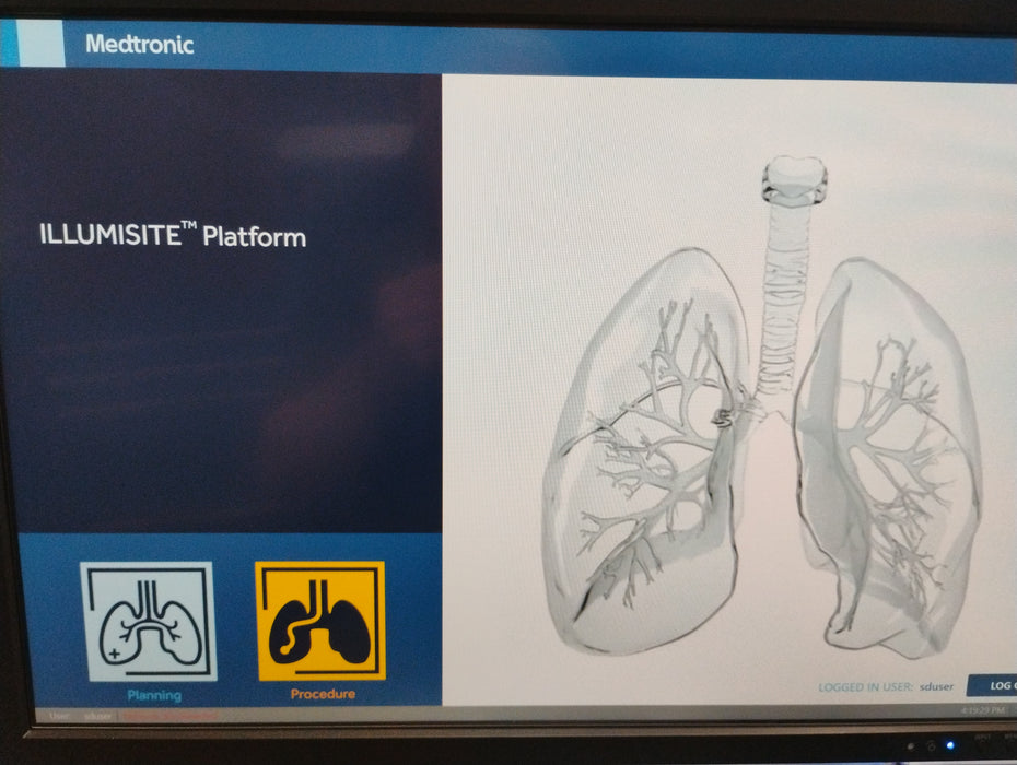 Medtronic Illumisite Fluoroscopic Navigation Platform