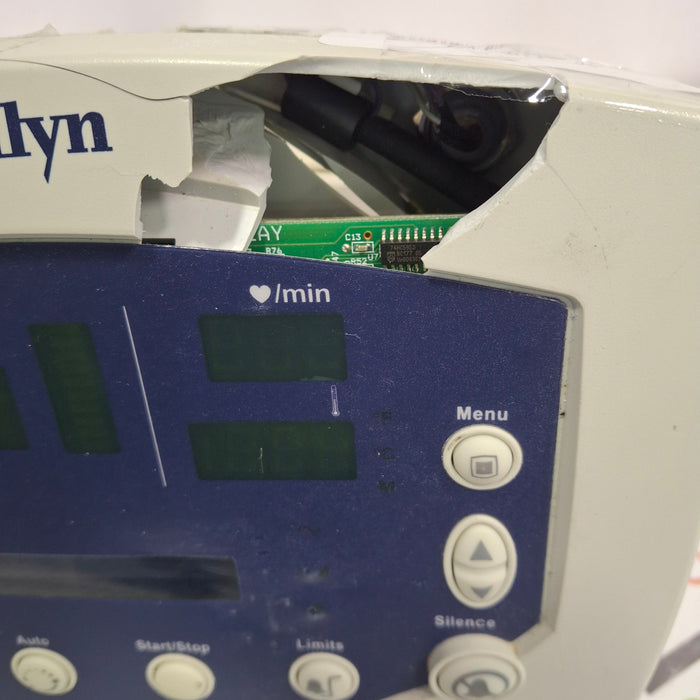 Welch Allyn 300 Series - Masimo SpO2, Temp Vital Signs Monitor