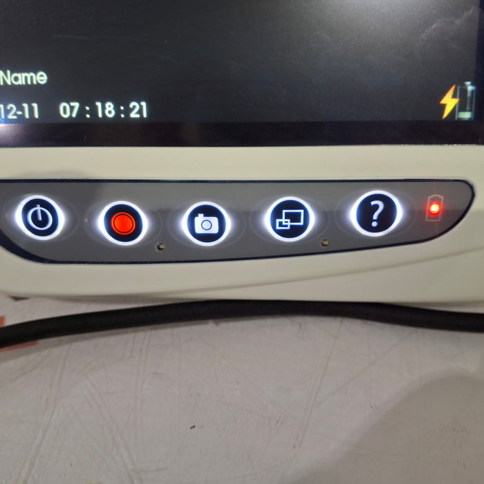 Verathon Medical, Inc Glidescope Video Laryngoscope