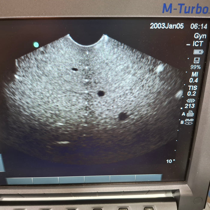 Sonosite ICTx/8-5 MHz Transvaginal Transducer