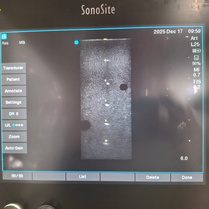 Sonosite SII Ultrasound