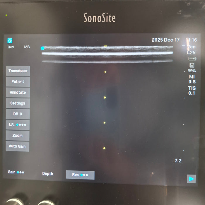 Sonosite SII Ultrasound