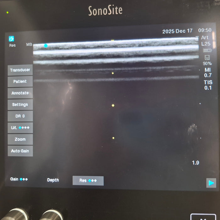 Sonosite SII Ultrasound