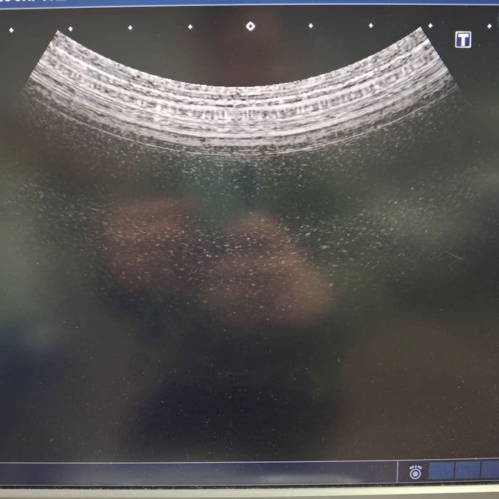 Toshiba PVT-375BT Convex Transducer