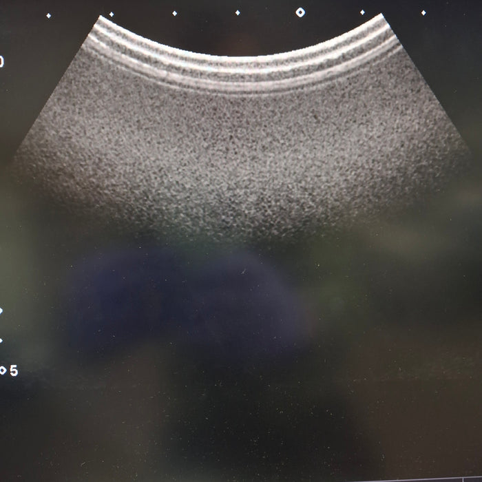 Toshiba PVT-674BT Convex Ultrasound Transducer