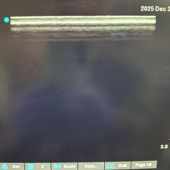 Sonosite L38xi 10-5 MHZ Linear Transducer