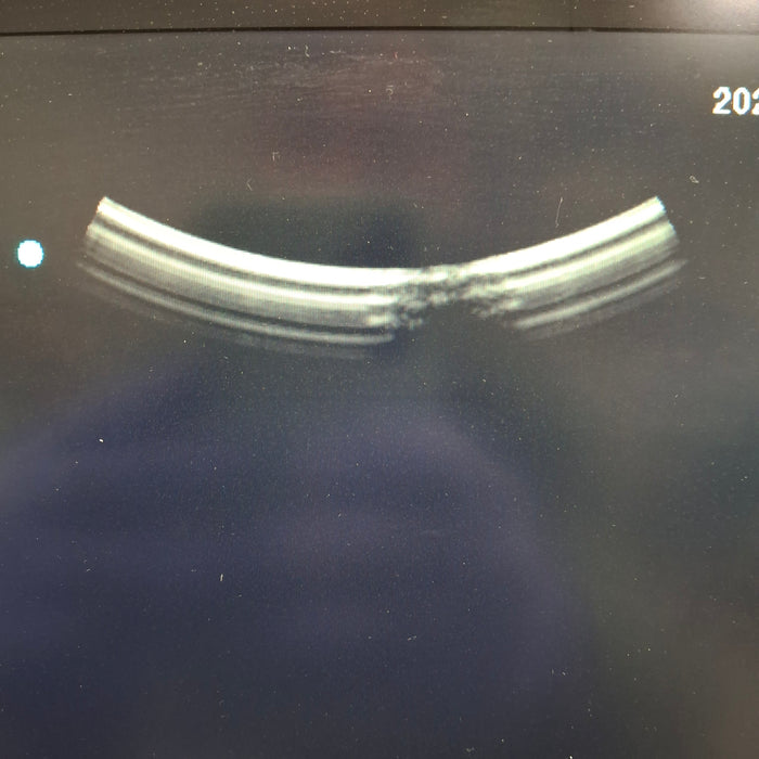 Sonosite rC60xi/5-2 MHz Curved Array Transducer
