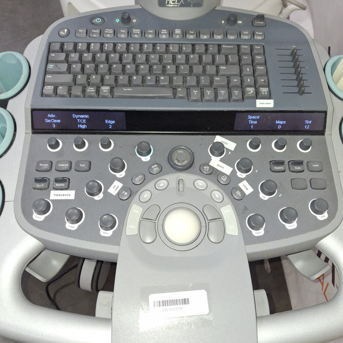 Siemens Acuson S3000 Ultrasound