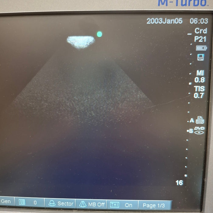 Sonosite P21x/5-1 MHz Phased Array Transducer