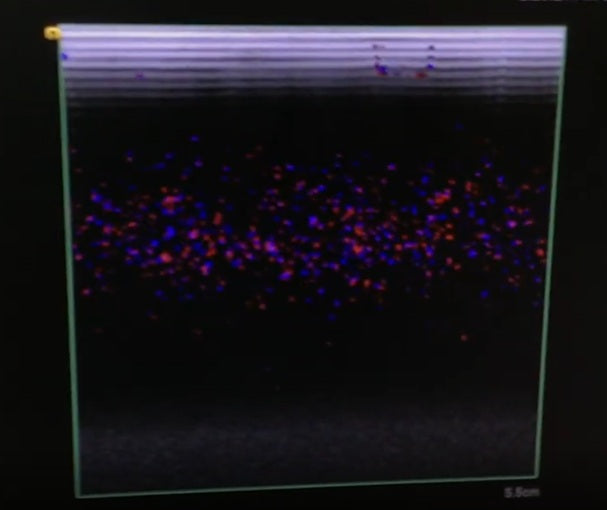 Siemens Acuson 18L6 HD Linear Transducer