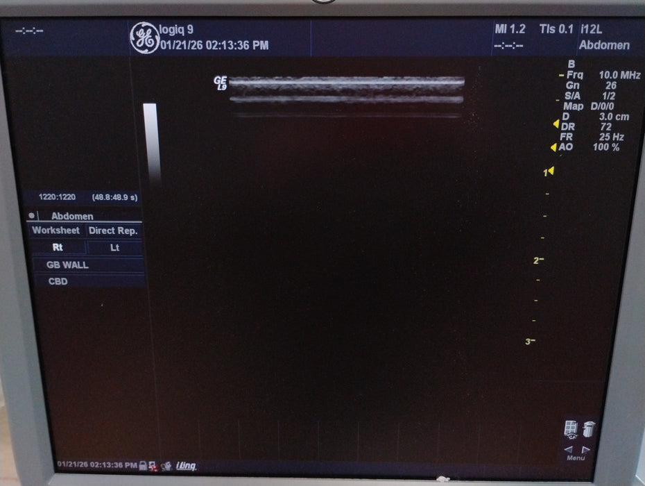 GE Healthcare Logiq 9 Ultrasound