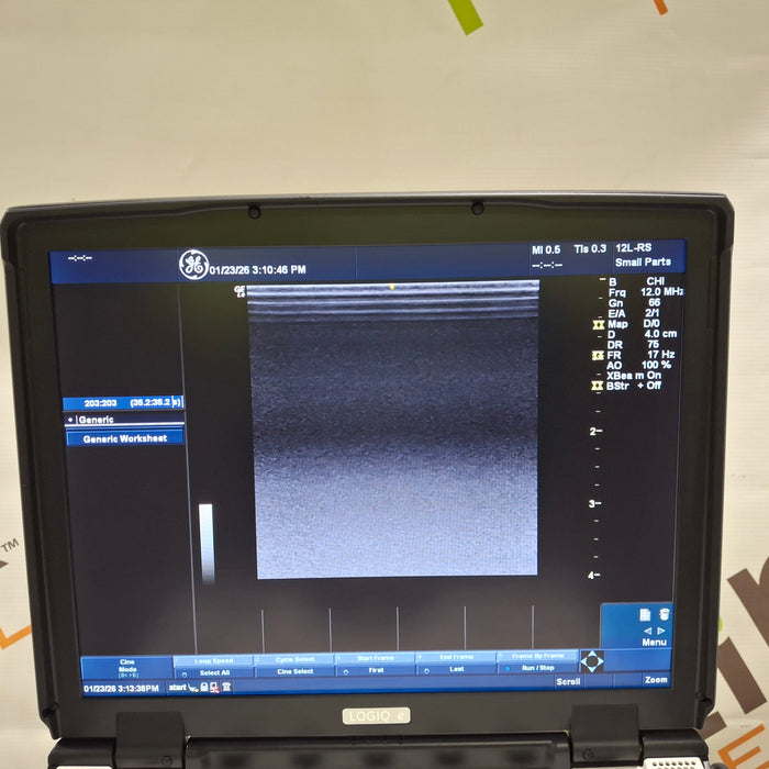 GE Healthcare NextGen Logiq e Ultrasound