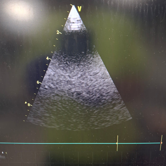 GE Healthcare Vivid E9 Ultrasound