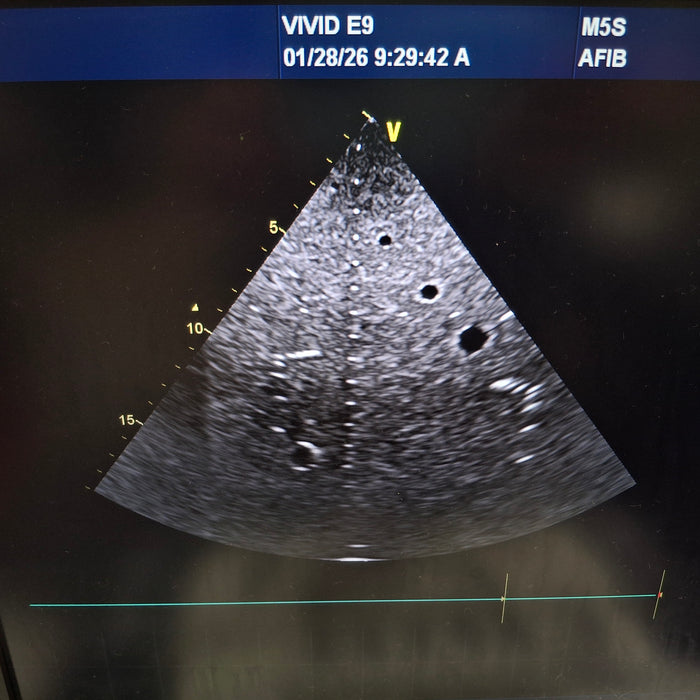 GE Healthcare Vivid E9 Ultrasound