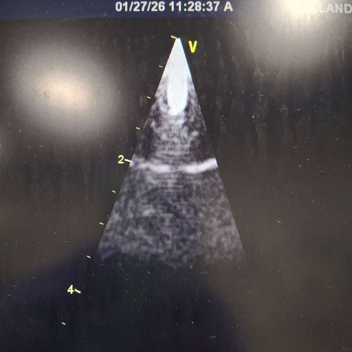 GE Healthcare 4V-D Volume Matrix Phased Array Transducer
