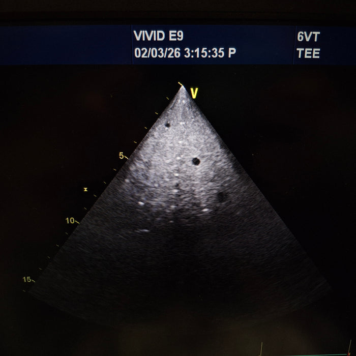 GE Healthcare 6VT-D Cardiac Transesophageal Probe
