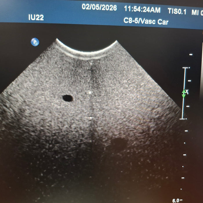 Philips C8-5 Curved Array Transducer