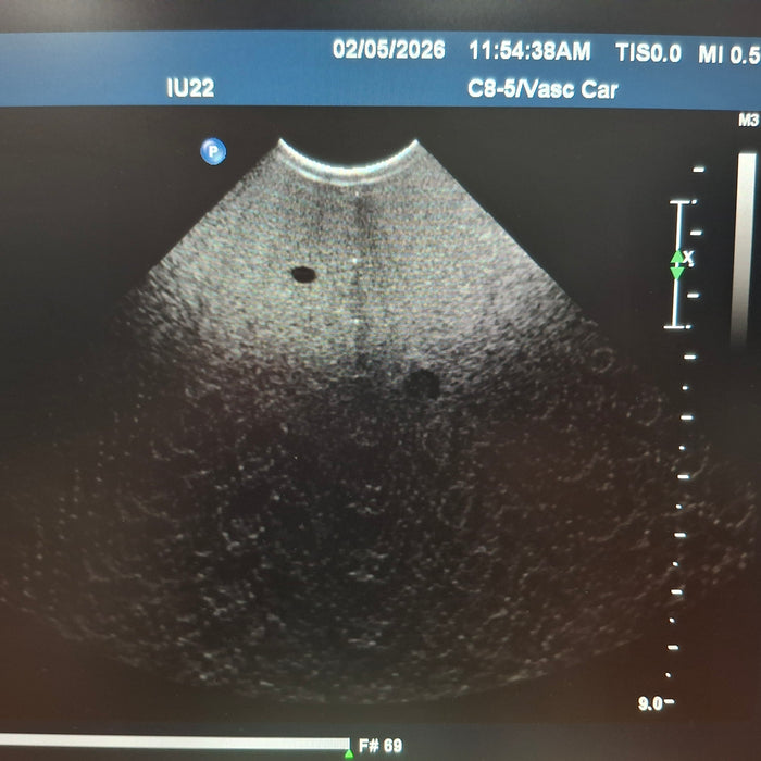 Philips C8-5 Curved Array Transducer