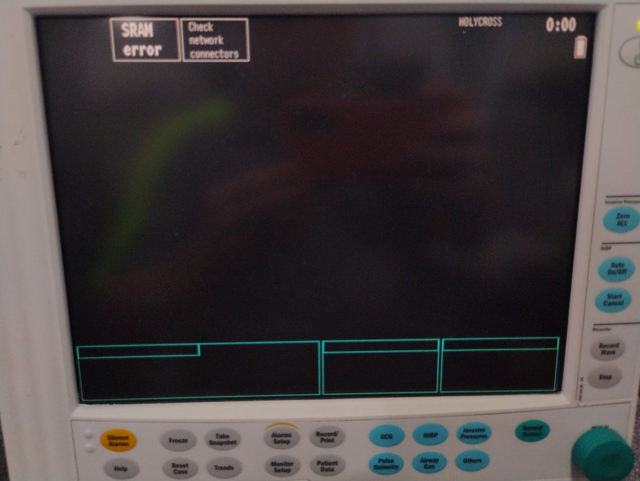 Datex-Ohmeda S/5 Compact Patient Monitor