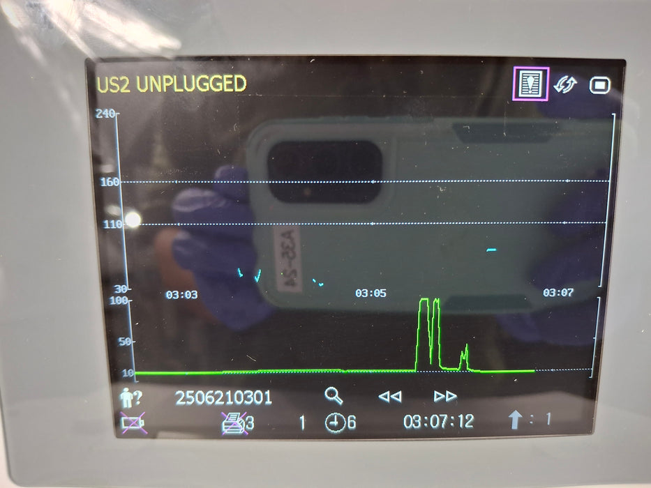 Wallach F3 Fetal Monitor