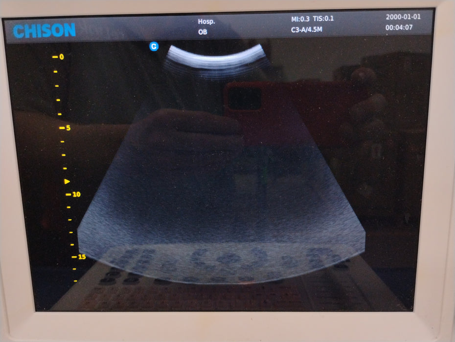 Chison Medical Imaging Co.,Ltd. ECO 3 Ultrasound