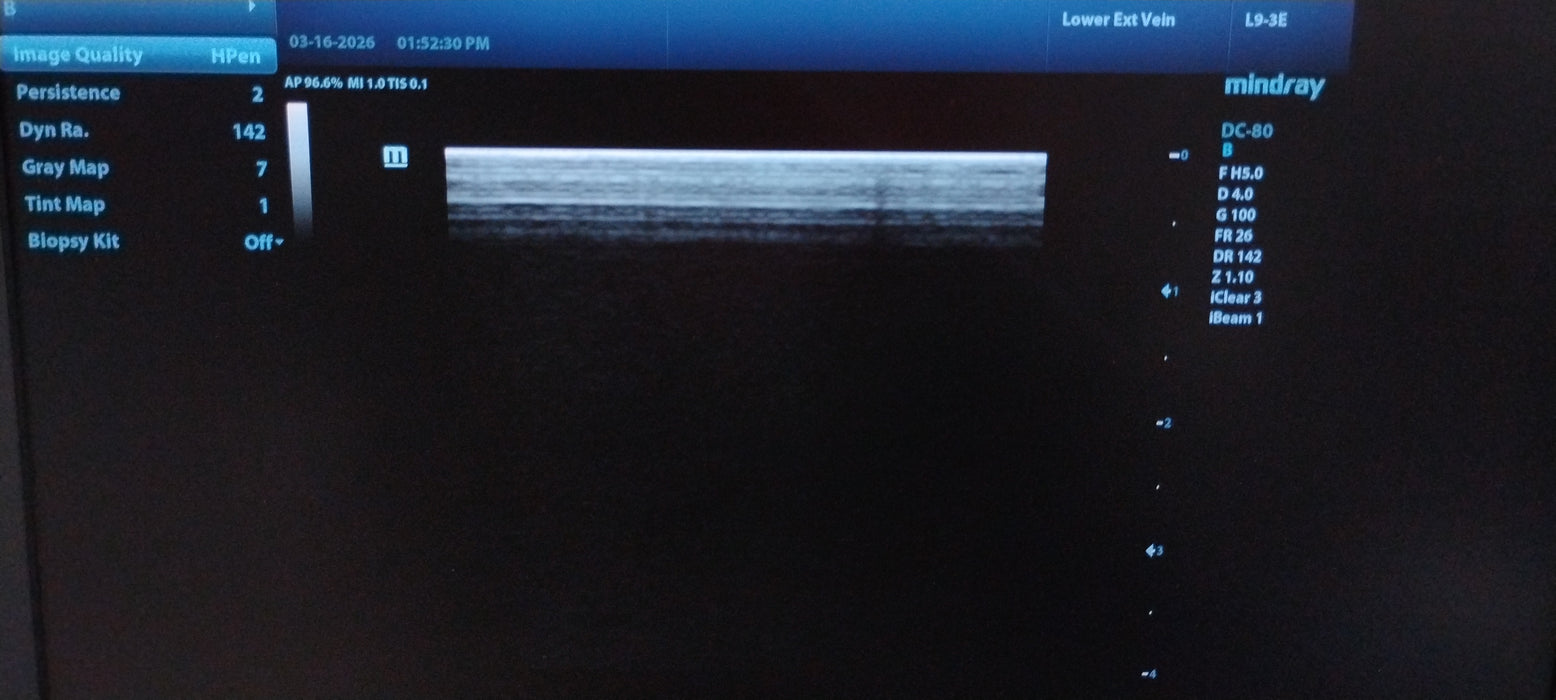 Mindray DC-80 Ultrasound System