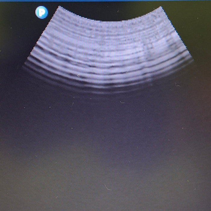 Philips HD3 Ultrasound