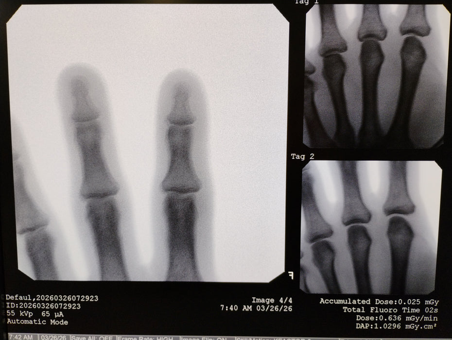 Orthoscan FD C-Arm