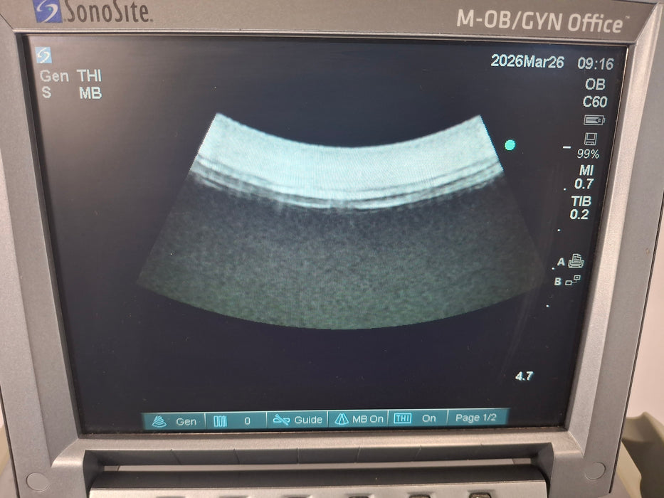 Sonosite M-Turbo Ultrasound