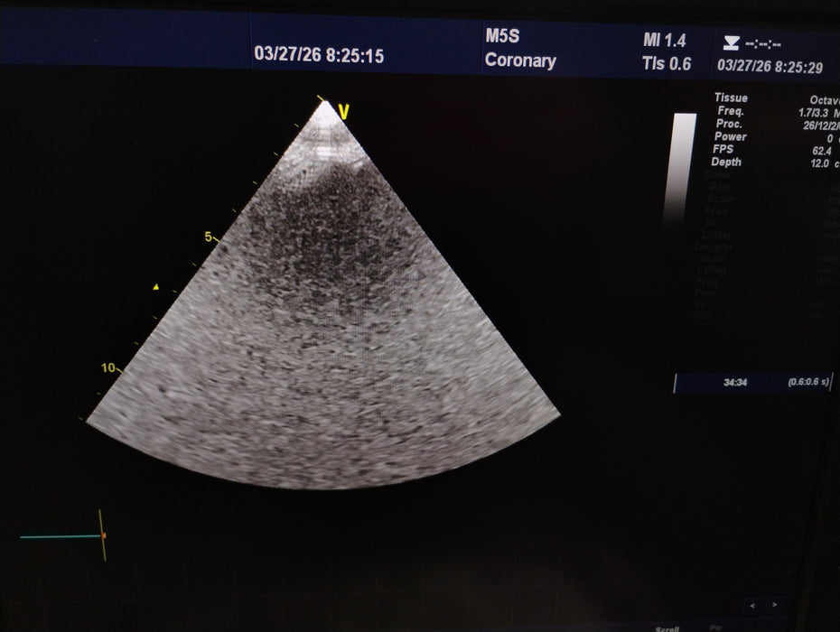 GE Healthcare M5S-D Matrix Phased Array