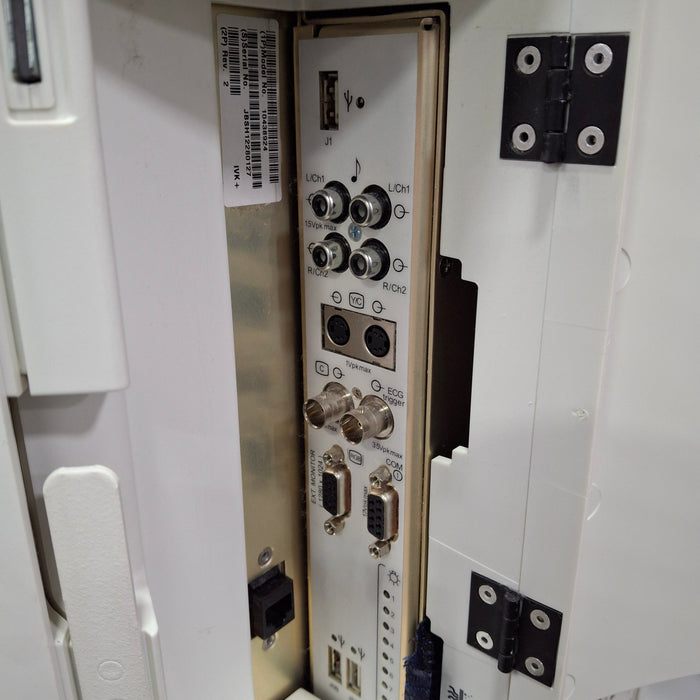 Siemens Acuson S1000 Ultrasound