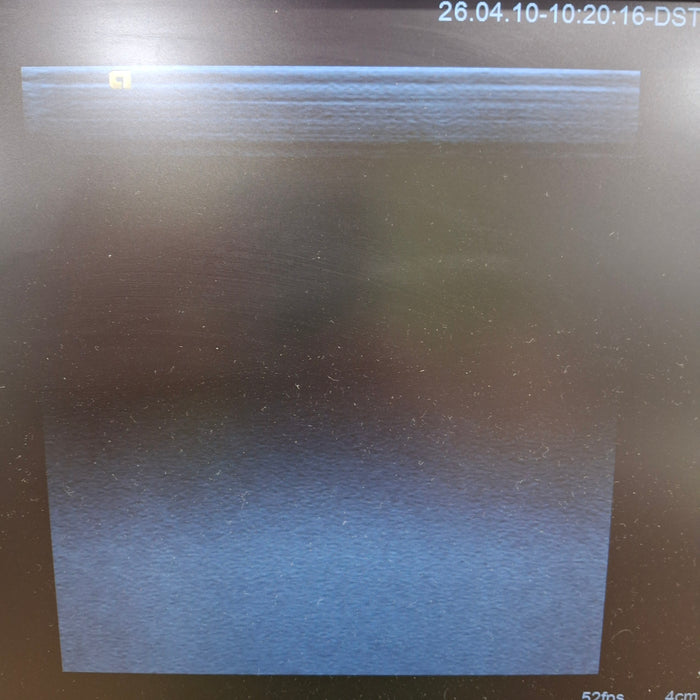 Siemens Acuson 14L5 Linear Transducer