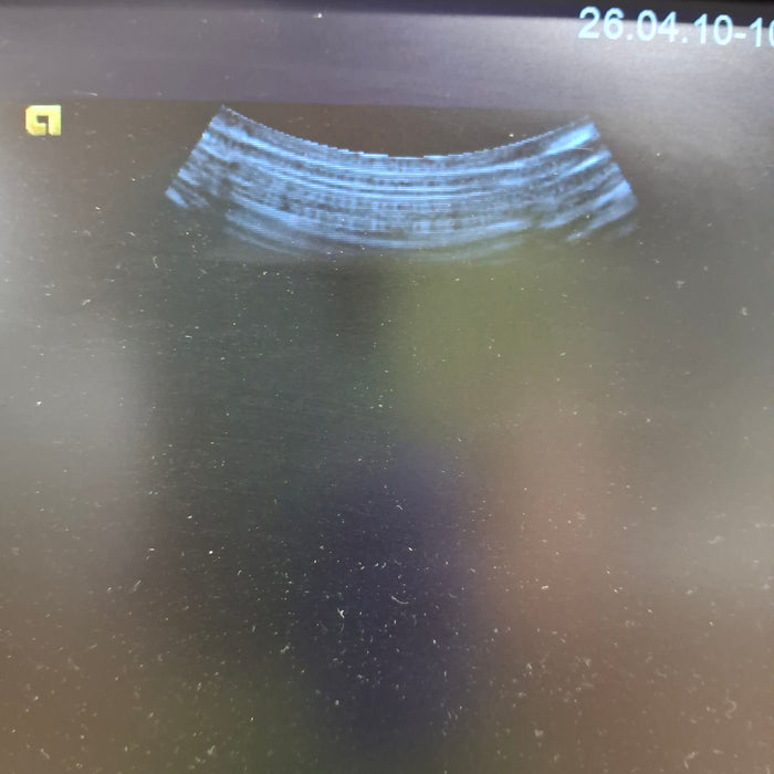 Siemens 4C1 Curved Transducer