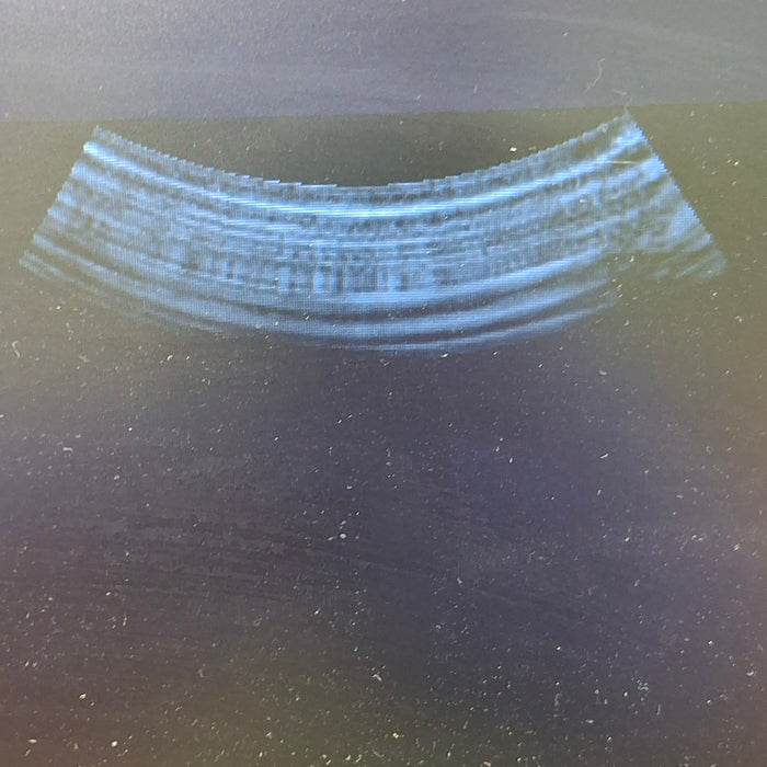 Siemens 4C1 Curved Transducer